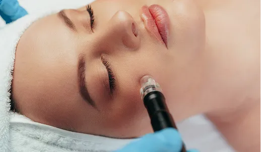 Injection esthétique au niveau du front réalisée par un professionnel de santé