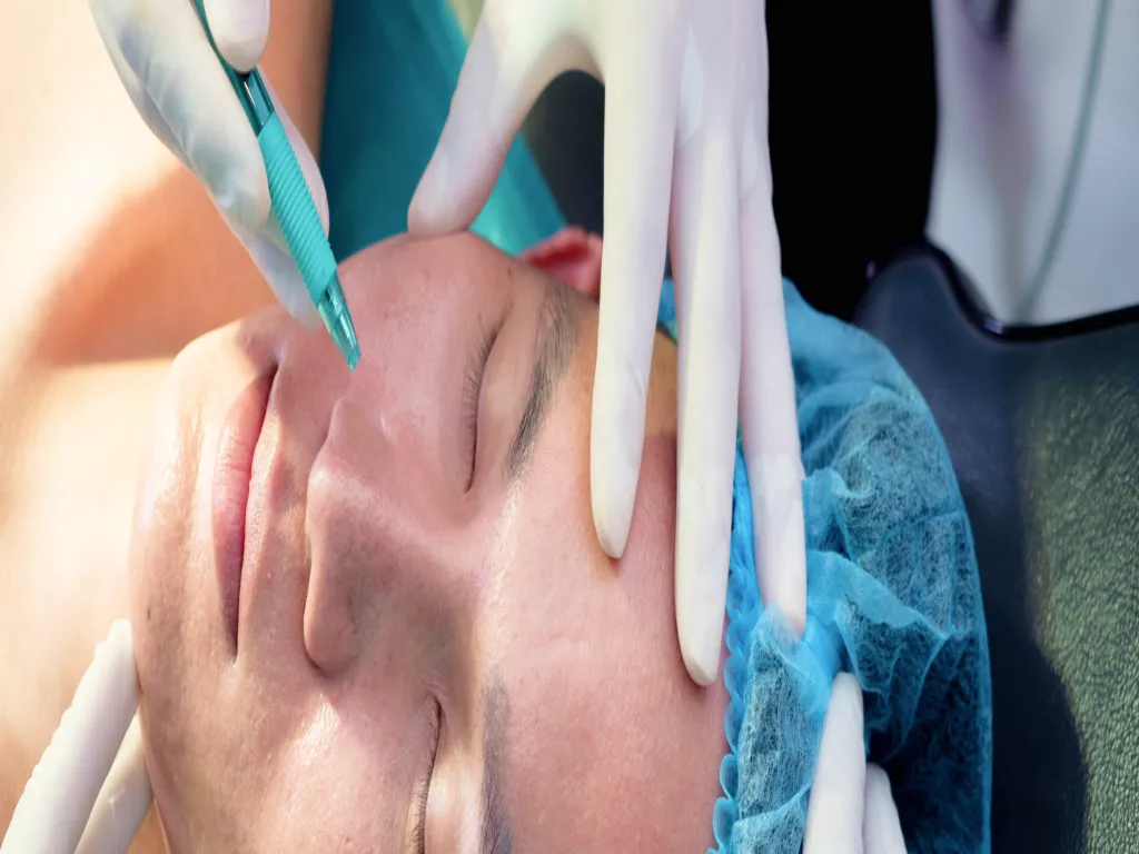 Chirurgie mineure au visage : mains gantées pratiquant une petite intervention près du nez d’un patient
