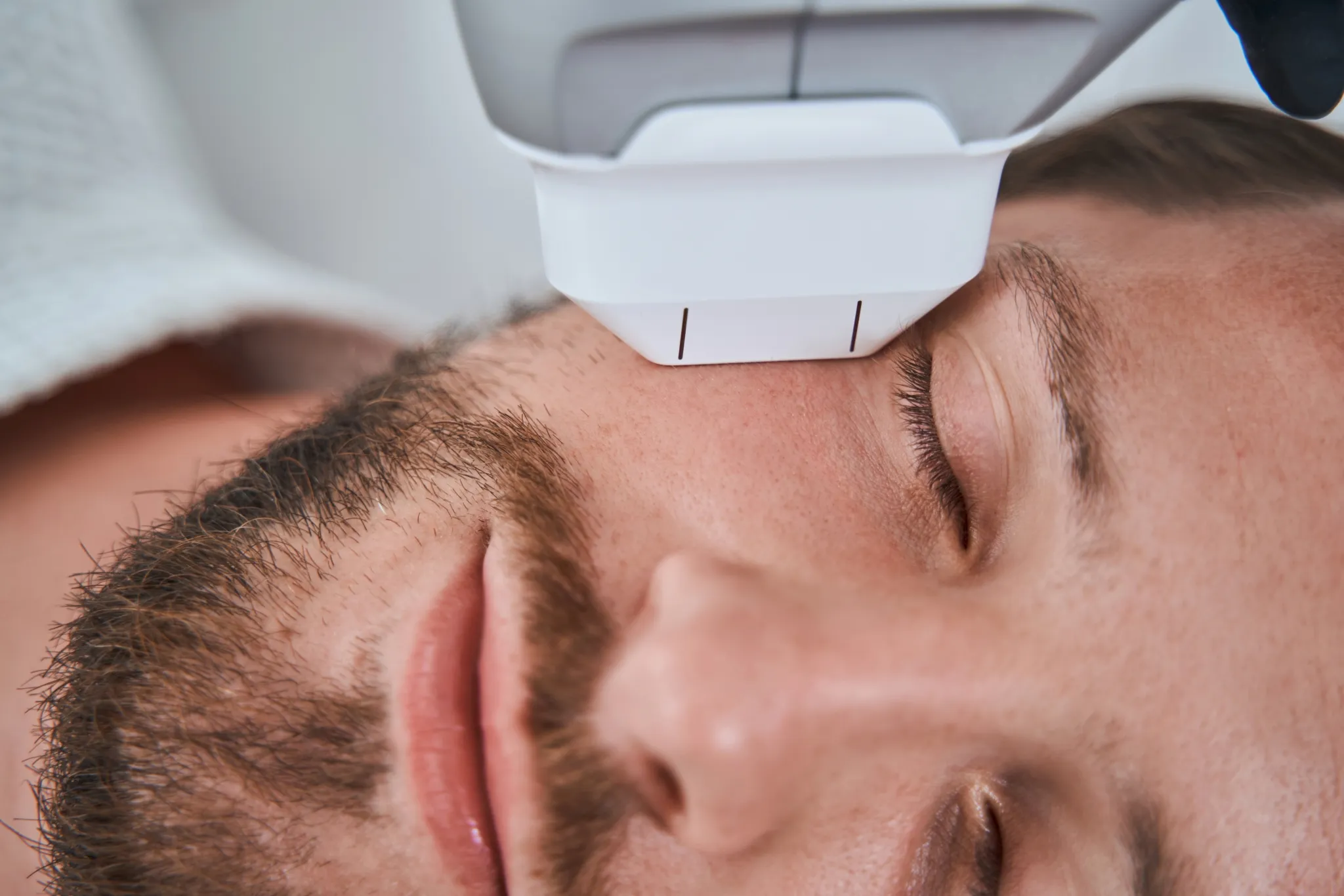 Jeune homme affichant un teint sain et soigné grâce aux traitements dermatologiques