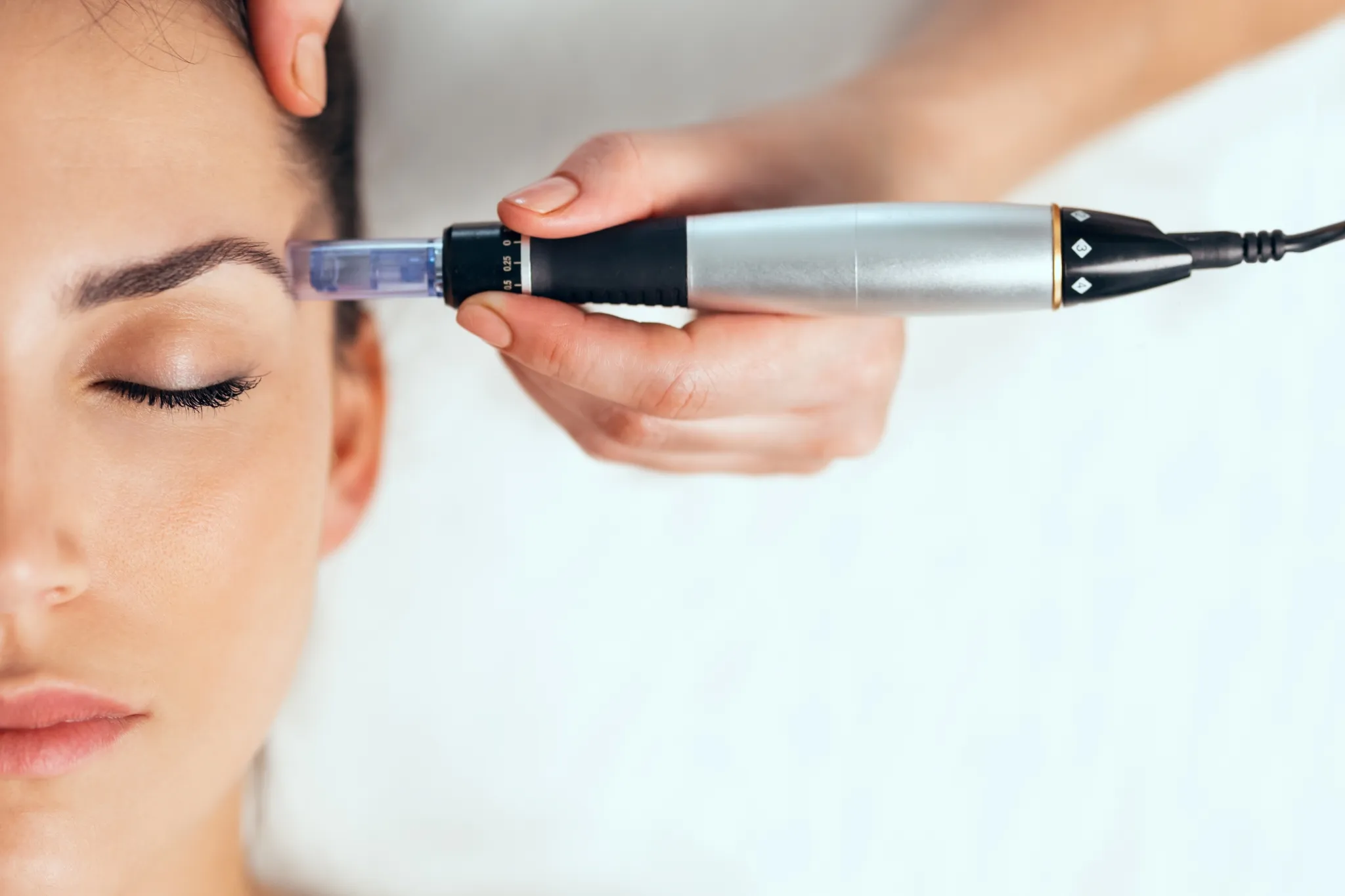 Détail d'un soin de microneedling facial visant à réduire les pores