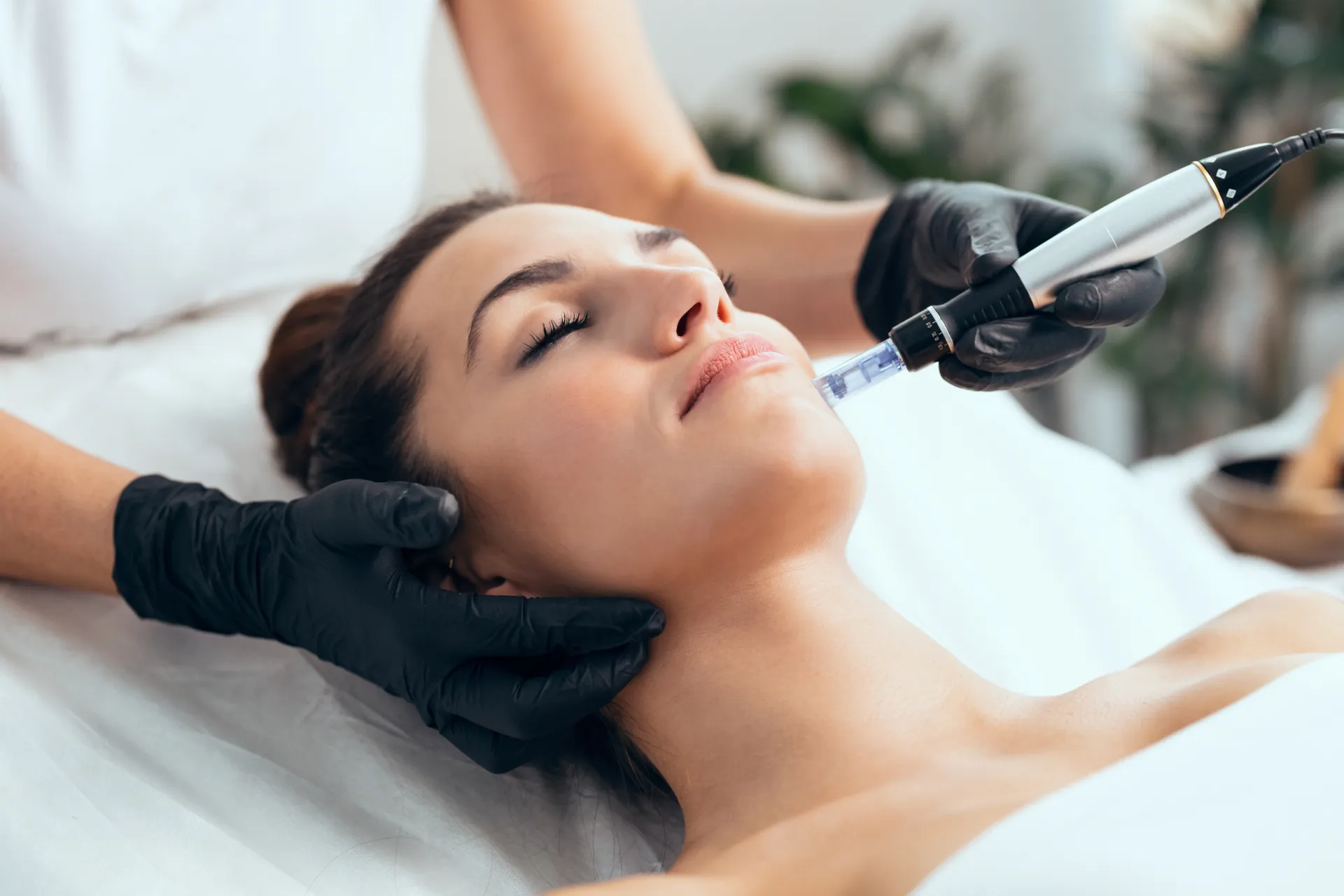 Stylo de microneedling appliqué au menton d’une patiente détendue, la tête soutenue par des mains gantées