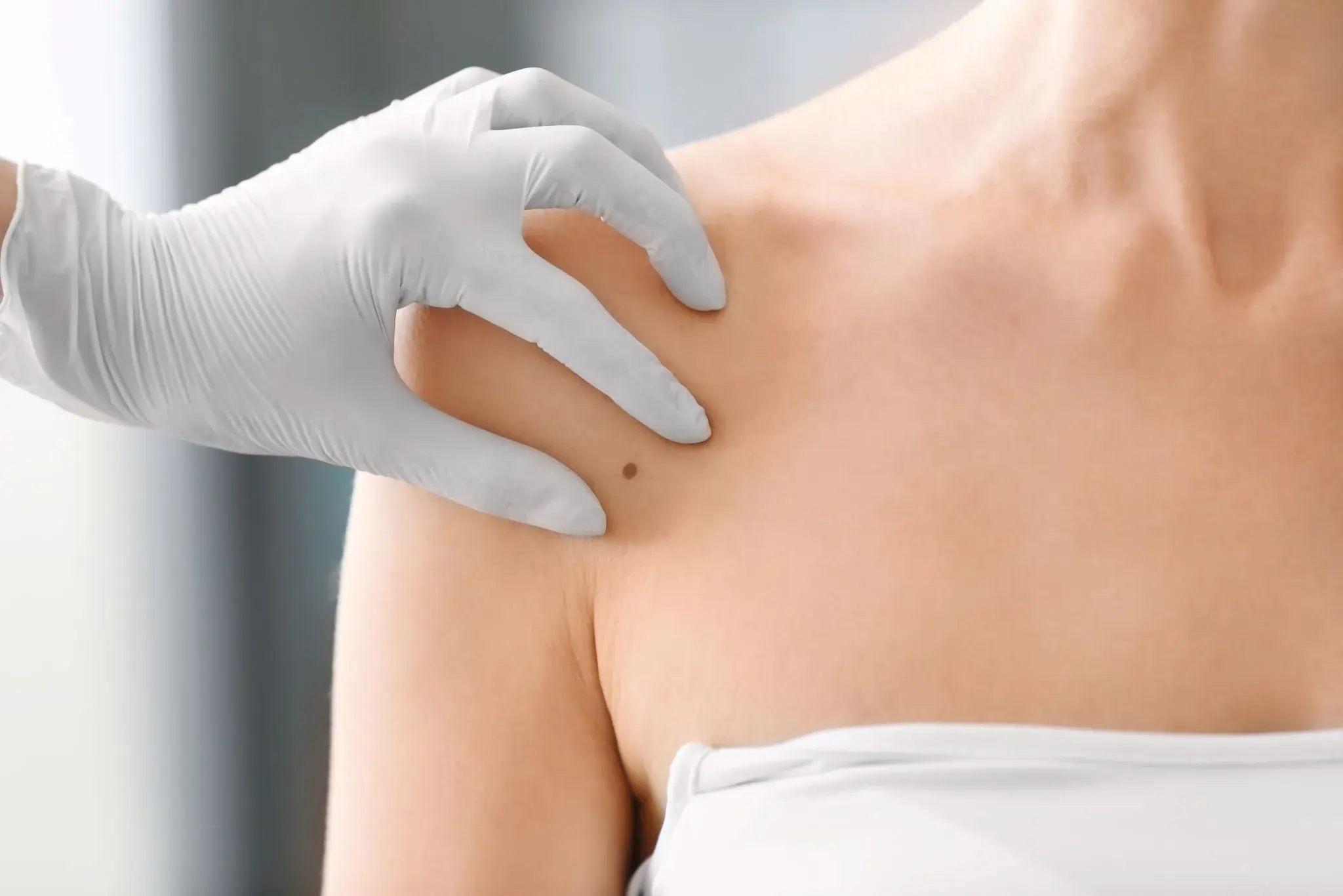 Examen de la peau et des grains de beauté en clinique de dermatologie