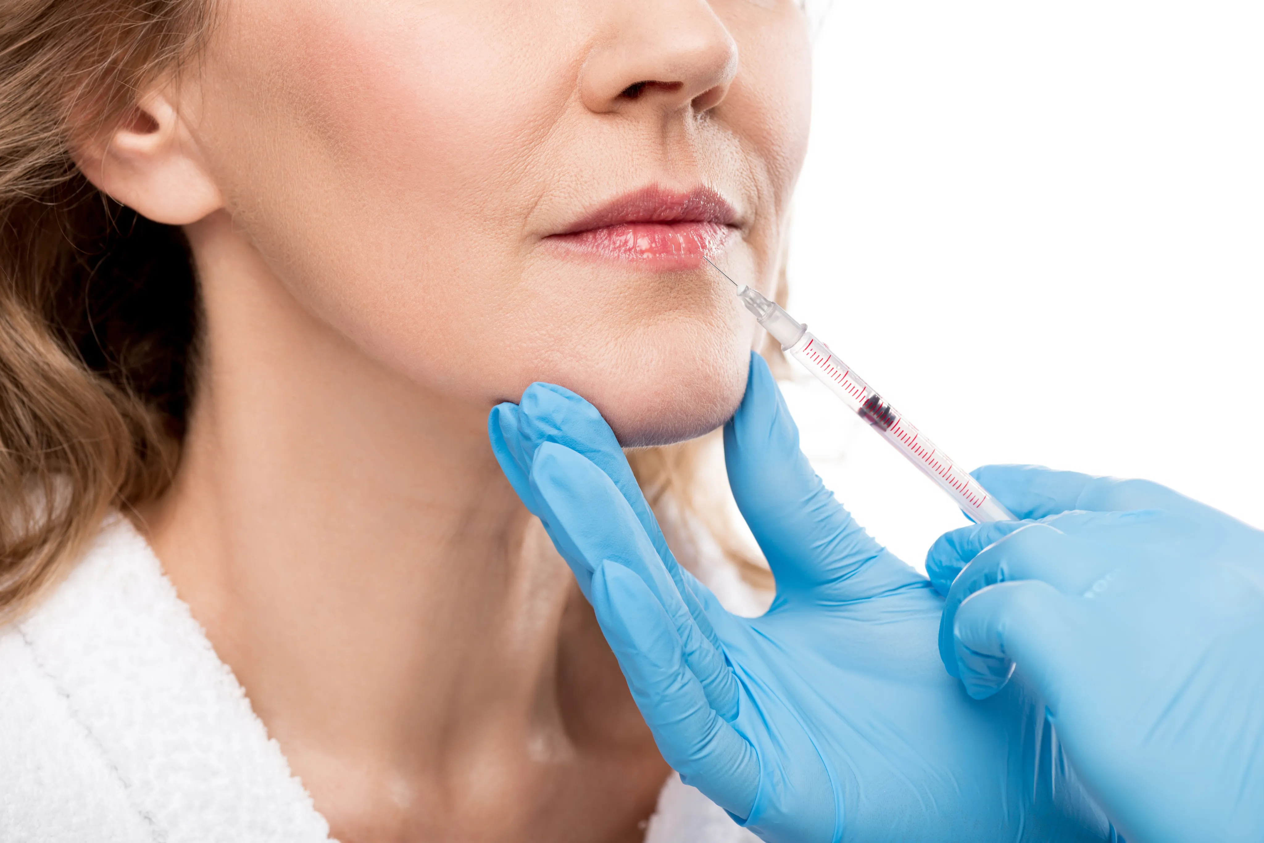 Procédure de remodelage des lèvres par injection