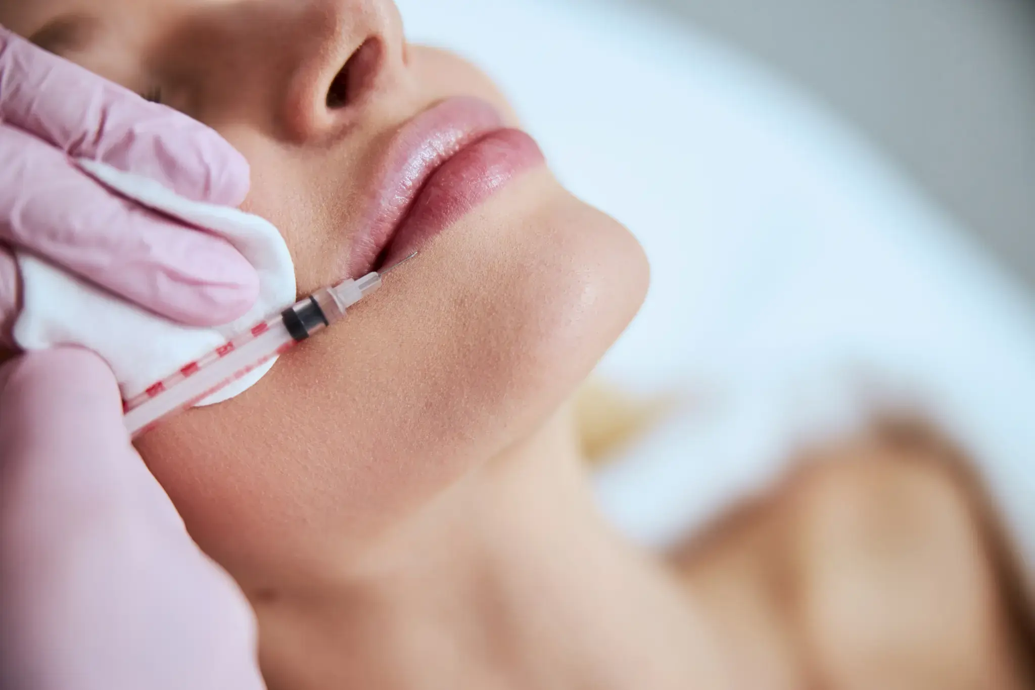 Injection esthétique pour traiter les lèvres de la patiente