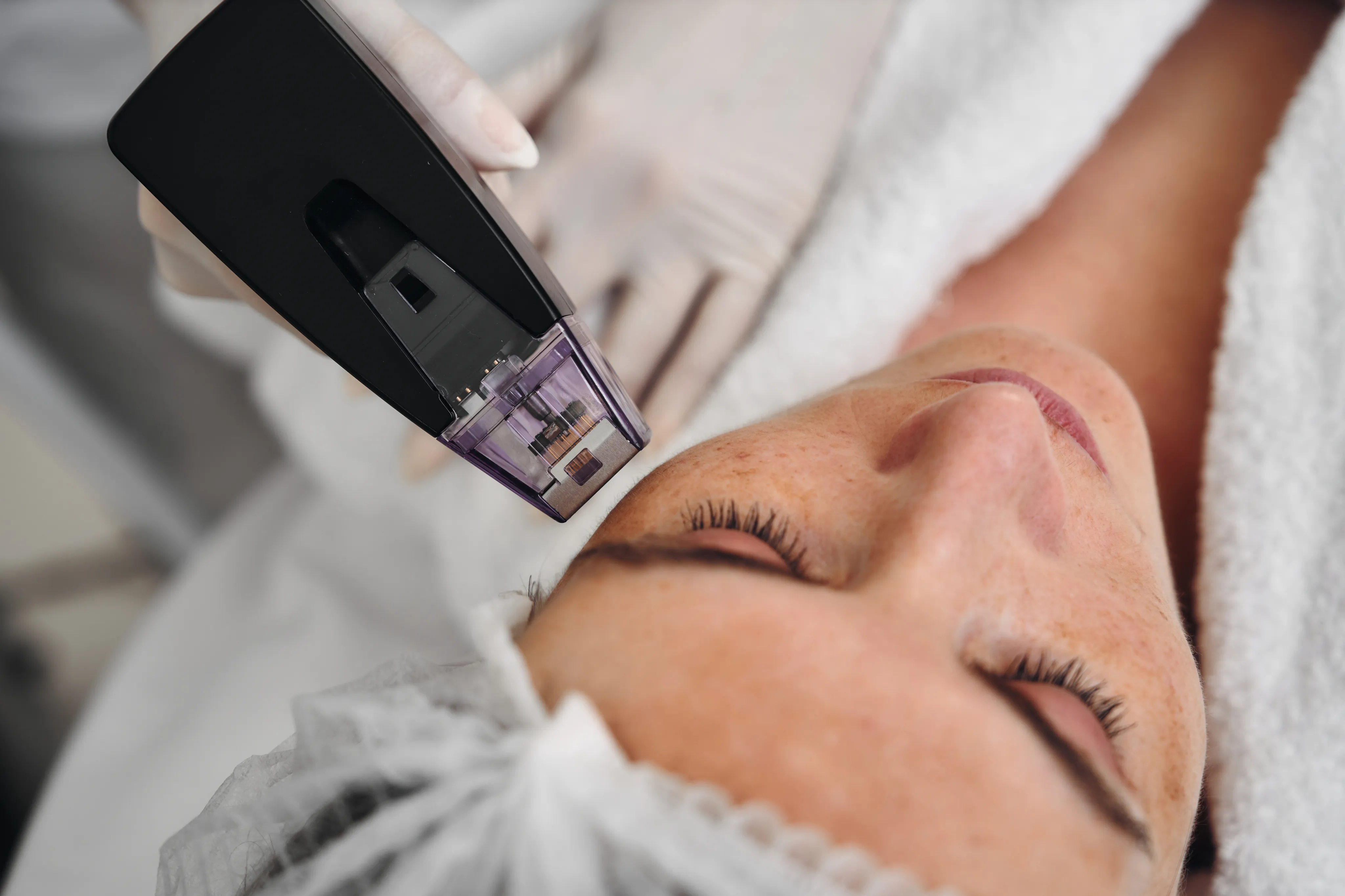 Traitement laser corporel pour améliorer la fermeté et l'aspect de la peau